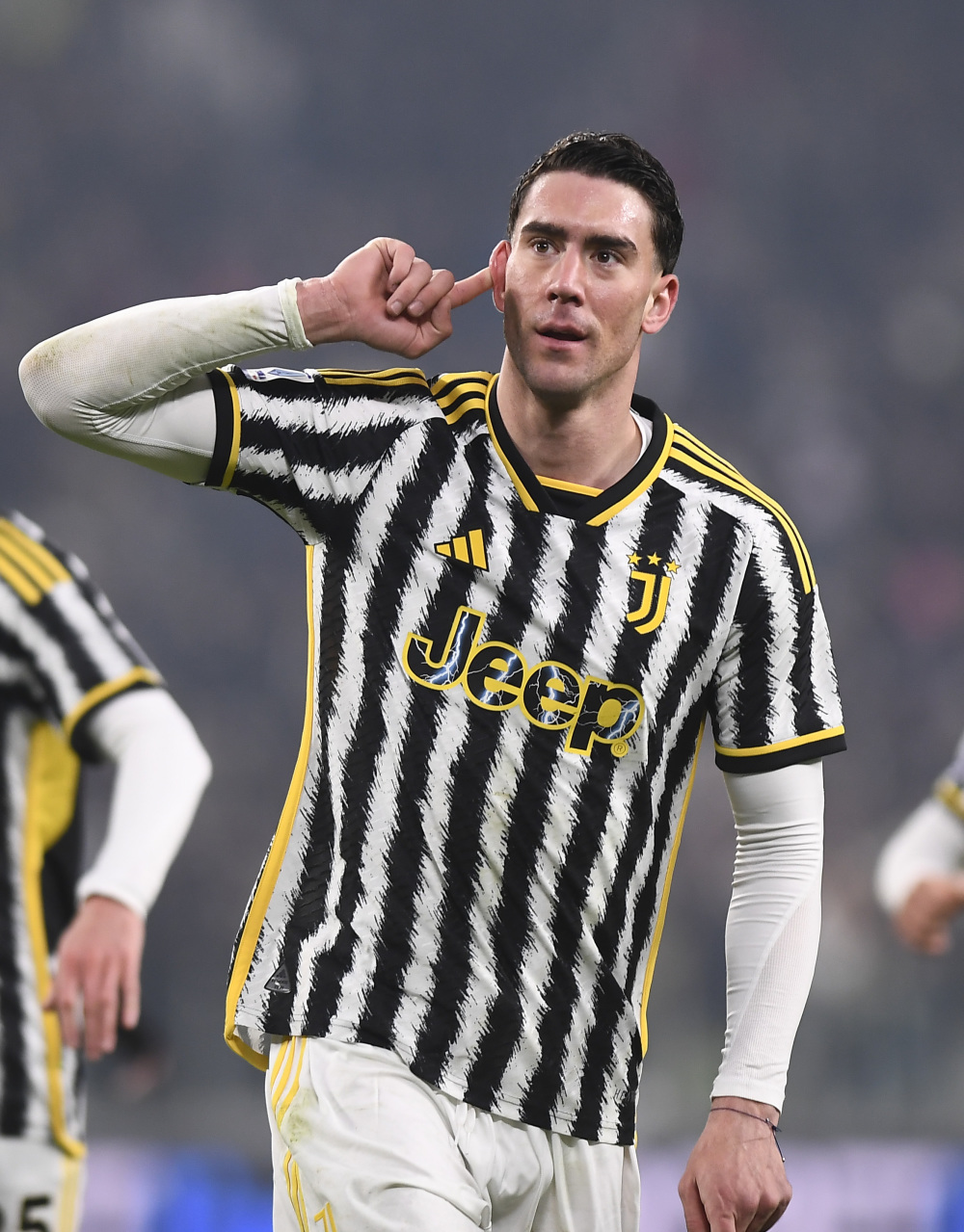 阿尔特塔谈球队伤病不断与训练无关